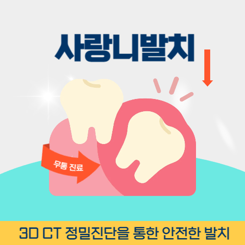 광양치과 광양시 치과 사랑니 발치